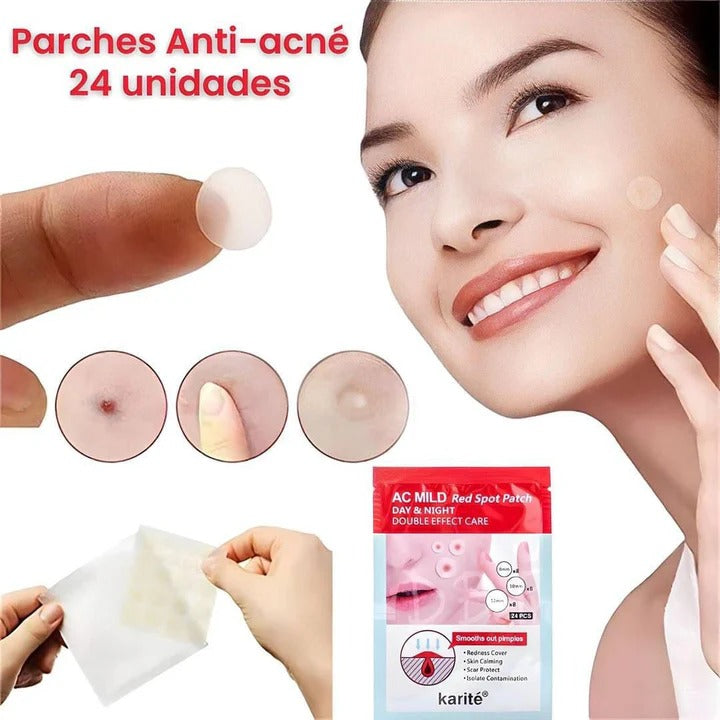 PARCHE ANTIACNE- 2 SOBRES KARITE (48 UND)