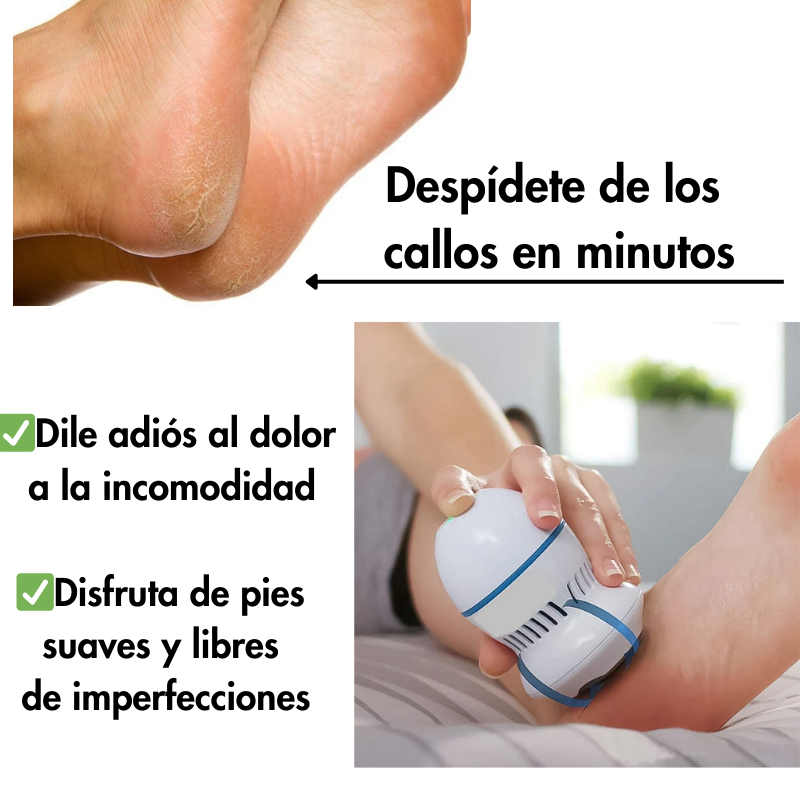 PediLuxe® Removedor  de callos y pulidor de pies
