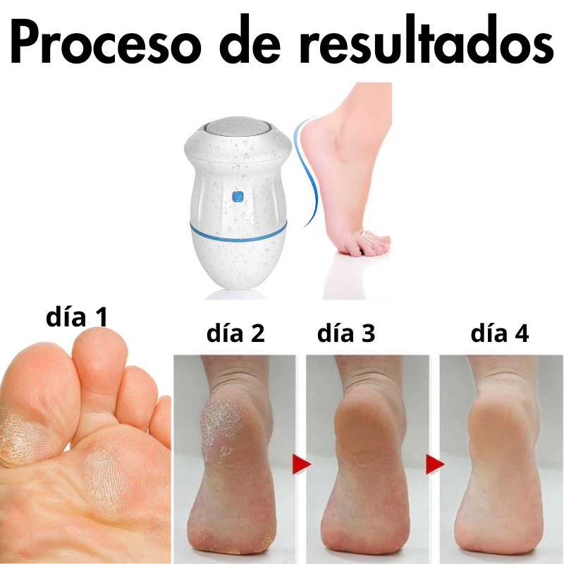 PediLuxe® Removedor  de callos y pulidor de pies